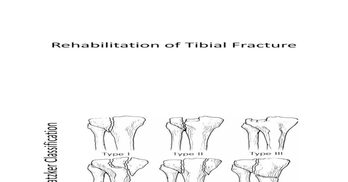 Rehabilitation Of Tibial Plateau Fracture Pdf Document