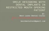 Smile designing with dental implants in restricted mouth opening patient