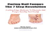 Curing Nail Fungus The 7 Step Revolution