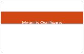 Myositis ossificans