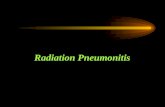 Radiation Pneumonitis