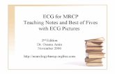 Ecg .. for Mrcp,Teaching Notes and Best of Fives With Ecg Pictures