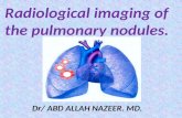 Presentation1.pptx radiological imaging of pulmonary nodules.