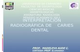 16.Interp Rx de Caries Dental Enviada Junio 2012