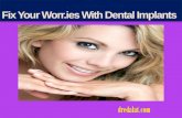 Fix your worries with dental implants