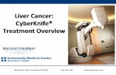 Liver Cancer: CyberKnife Treatment Overview