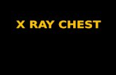Chest x rays