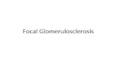 Focal Glomerulosclerosis