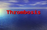 Thrombosis Ppt