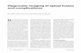 Featured Applied Radiology Article - Diagnostic Imaging of Spinal Fusion and Complications