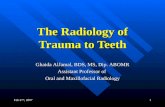 Radiologic Interpretation of Trauma to Teeth