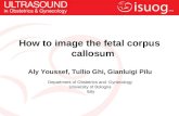 How to image the fetal corpus callosum