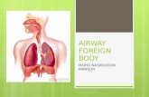 Airway foreign body