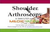 Shoulder Arthroscopy surgery & Treatment