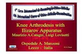Knee Arthrodesis with Ilizarov Apparatus. Maurizio A.Catagni, Luigi Lovisetti