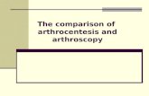 Comparison of Arthrocentesis and Arthrocopy