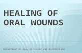 Healing of Oral Wounds