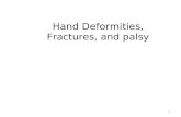 6 - Hand Deformities, Fractures, And Palsy