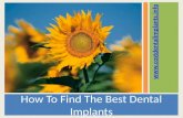 All that is included with dental implants