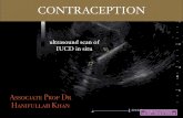 CONTRACEPTION OVERVIEW