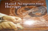 Hand Acupuncture Therapy