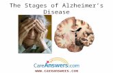 The Stages of Alzheimer’s Disease