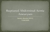 Ruptured Abdominal Aortic Aneurysm.ppt - Ruptured Abdominal Aortic ...