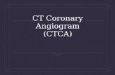 CT Coronary Angiography (CTCA)
