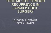 Trocar Site Tumour Recurrence In Laparoscopic Surgery India