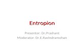 Entropion and its surgical correction