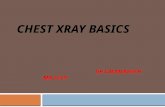 Xray basics by me