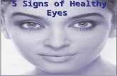 5 Signs Of Healthy Eyes