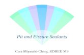 Pit & fissure sealants (1)