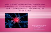 Level of Tumor Protein Indicates Chances Cancer Will Spread AND Malfunctioning Gene Associated With Lou Gehrig's Disease Leads to Nerve-Cell Death in Mice