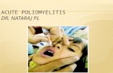 Acute poliomyelitis