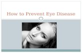 How to Prevent Eye Diseases