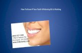 Dentist in Richmond Virginia How To Know If Your Teeth Whitening Kit Is Working