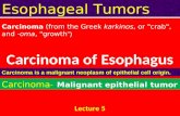 Carcinoma of esophagus n