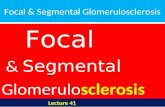 Focal & segmental glomerulosclerosis