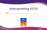 Interpreting ecg