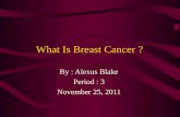 What is breast cancer