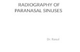 Radiography; Paranasal Sinus