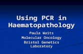 Using PCR in Haematopathology Paula Waits Molecular Oncology Bristol Genetics Laboratory.