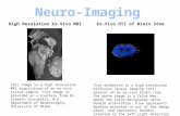 High Resolution Ex-Vivo MRIEx-Vivo DTI of Brain Stem This image is a high resolution MRI acquisition of an ex-vivo tissue sample. This image is provided.