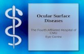 Ocular Surface Diseases The Fourth Affiliated Hospital of CMU Eye Centre.
