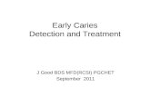Early Caries Detection and Treatment J Good BDS MFD(RCSI) PGCHET September 2011.