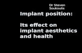 Implant position: Its effect on implant aesthetics and health Dr Steven Soukoulis.