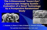 The 3-Dimensional Insect Eye Laparoscopic Imaging System - Evaluation of a Novel Technology by a Prospective Randomized Study Y. Kaufman, A. Sharon, O.