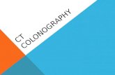 CT COLONOGRAPHY. CRC TRENDS 1970-1990  Incidence decreased by 7%  Mortality decreased by 20%  Five year survival rates increased by 12%