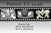 Pelvic CT.  Indications.  Contraindications.  Pelvic CT protocols. - Truma protocol. - Pathology protocol.  Patient after care.
